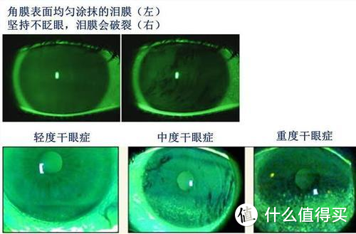 10 月 13 日是「世界视力日」，视力损伤流行率随年龄增长上升，怎样提前预防眼部疾病？有效护眼攻略