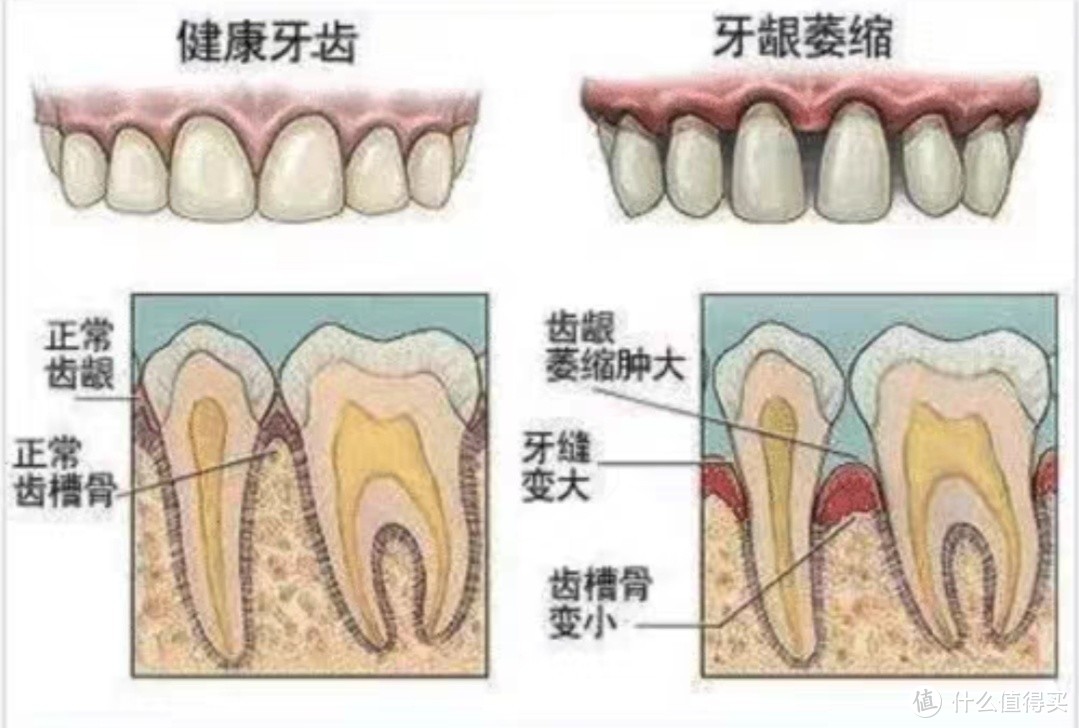 天天按时刷牙，牙齿还是发黄的原因