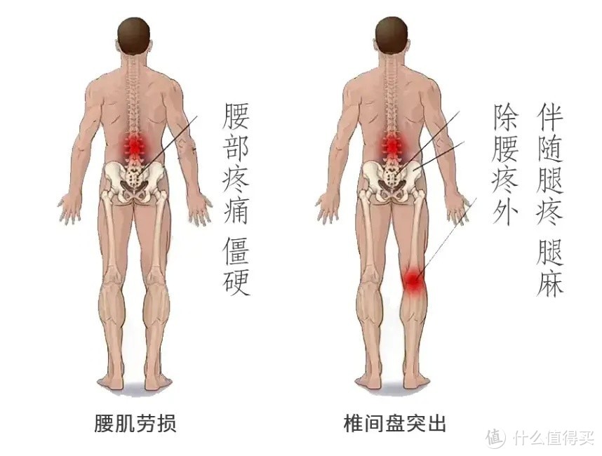 腰肌劳损和腰椎间盘突出的表现