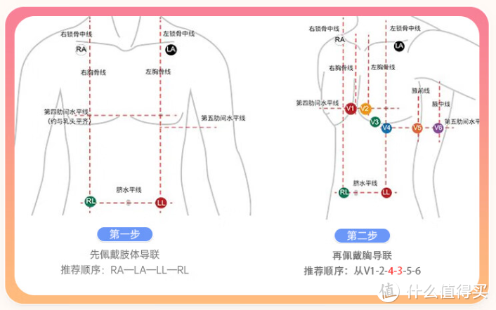 监护五导联位置图片图片