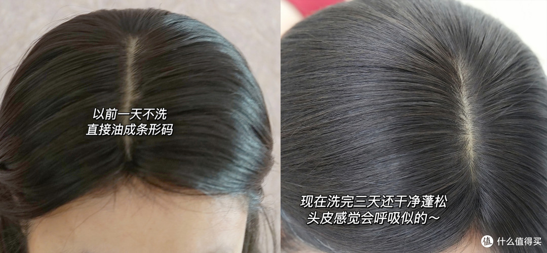 分享我的油头神级洗护好物——海飞丝控油绿瓶！秋冬真的赢麻了...