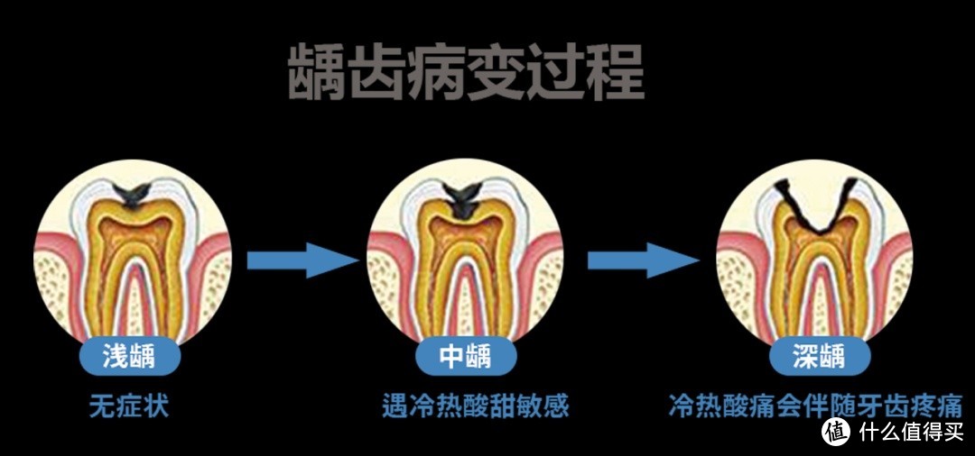 补不补牙？超详细的补牙指南来咯，建议收藏！