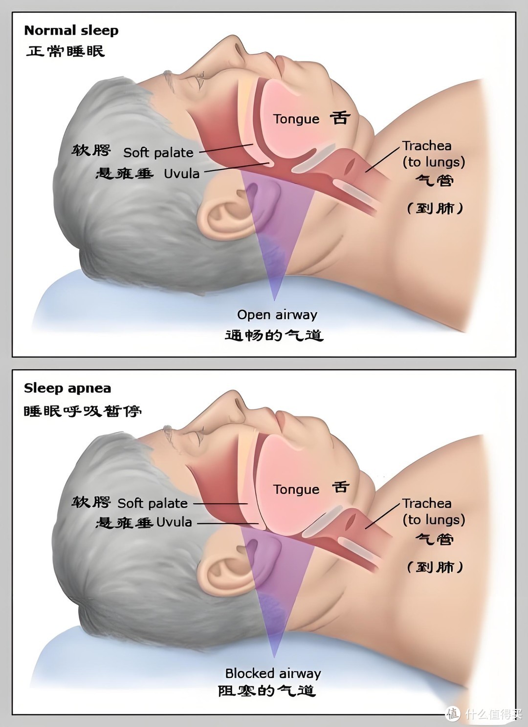 有氧止鼾，静享好梦，乐普多导双水平呼吸机，让家人睡上好觉！