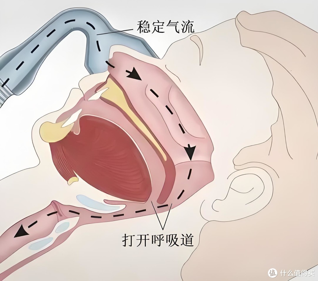 有氧止鼾，静享好梦，乐普多导双水平呼吸机，让家人睡上好觉！