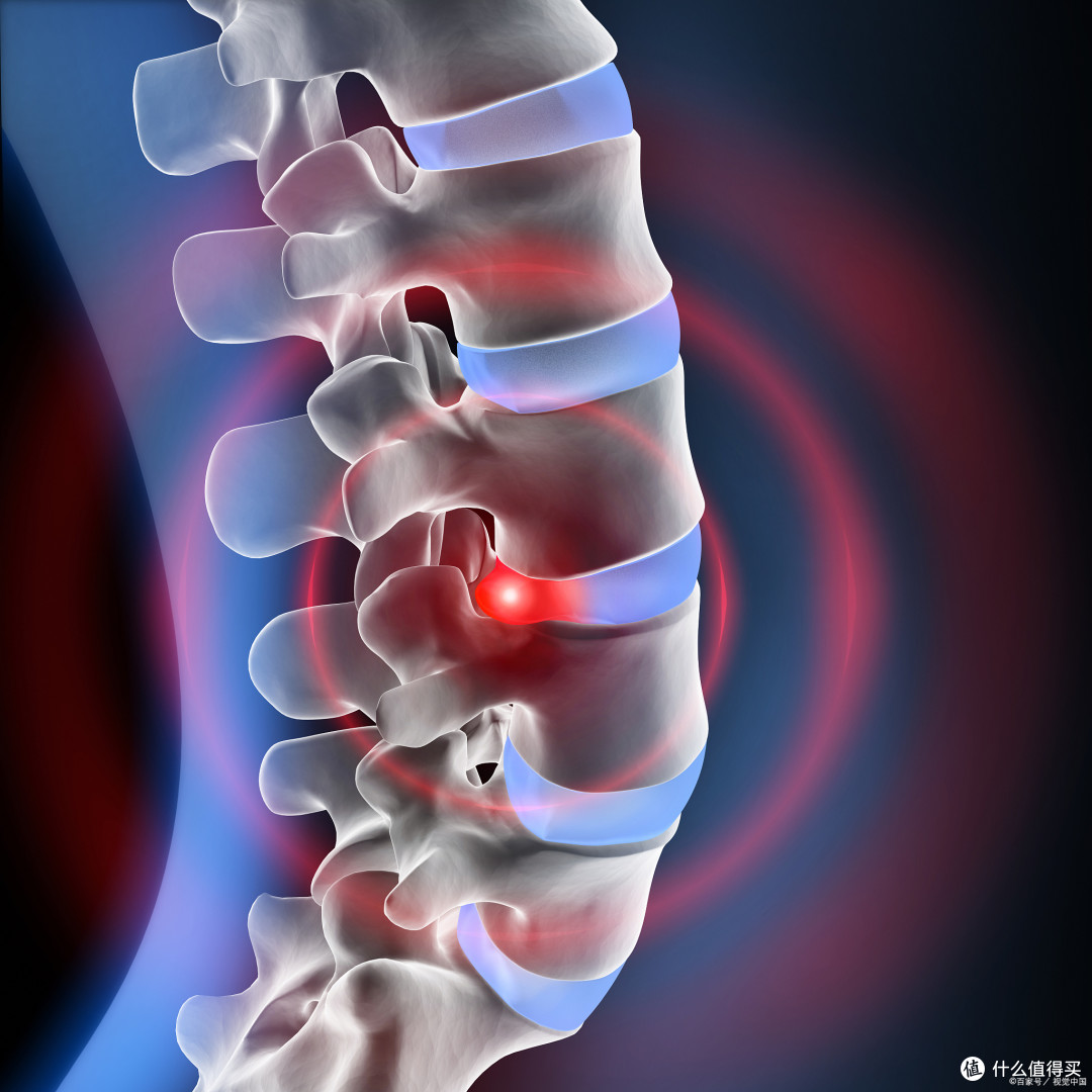 为什么腰间盘突出